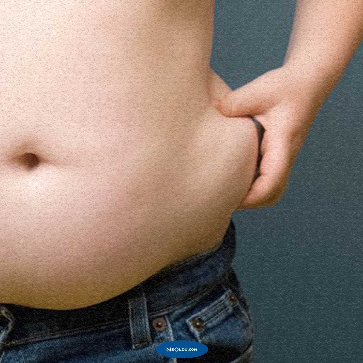 Obezite Koronavirüs Riskini Arttırır mı