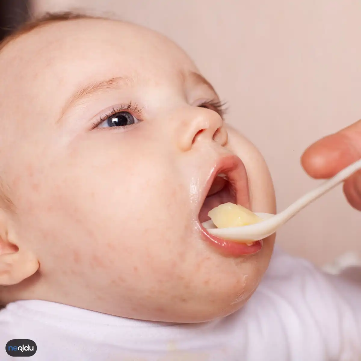 Bebeklerde Görülen Muz Alerjisi Neden Olur?