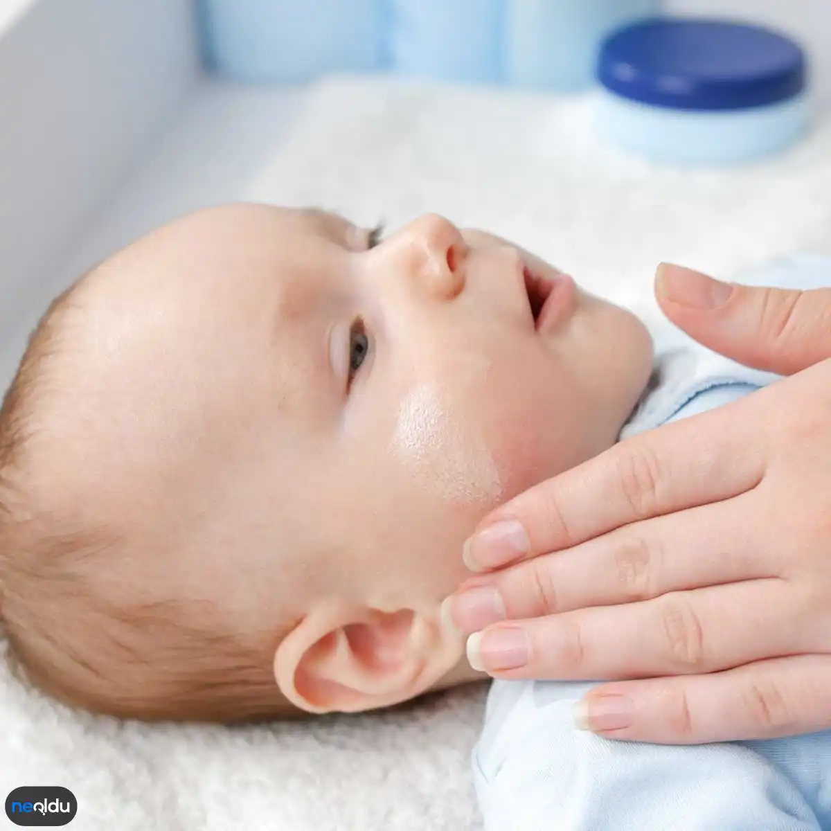 Bebeklerde İsilik Nedir, Belirtileri Nelerdir? Tedavisi