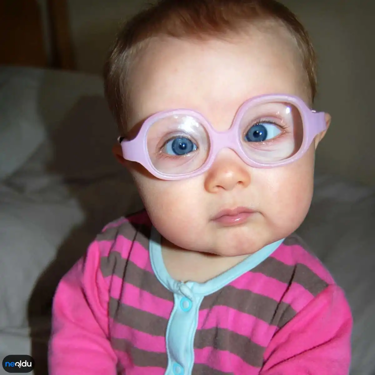Çocuklarda Görülen Göz Hastalıkları