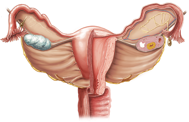 endometrial-polipler.png