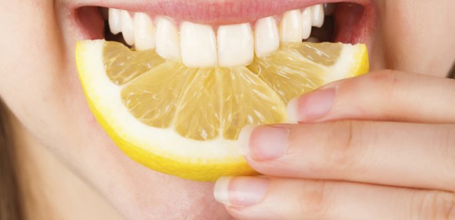 diş beyazlatma yöntemleri