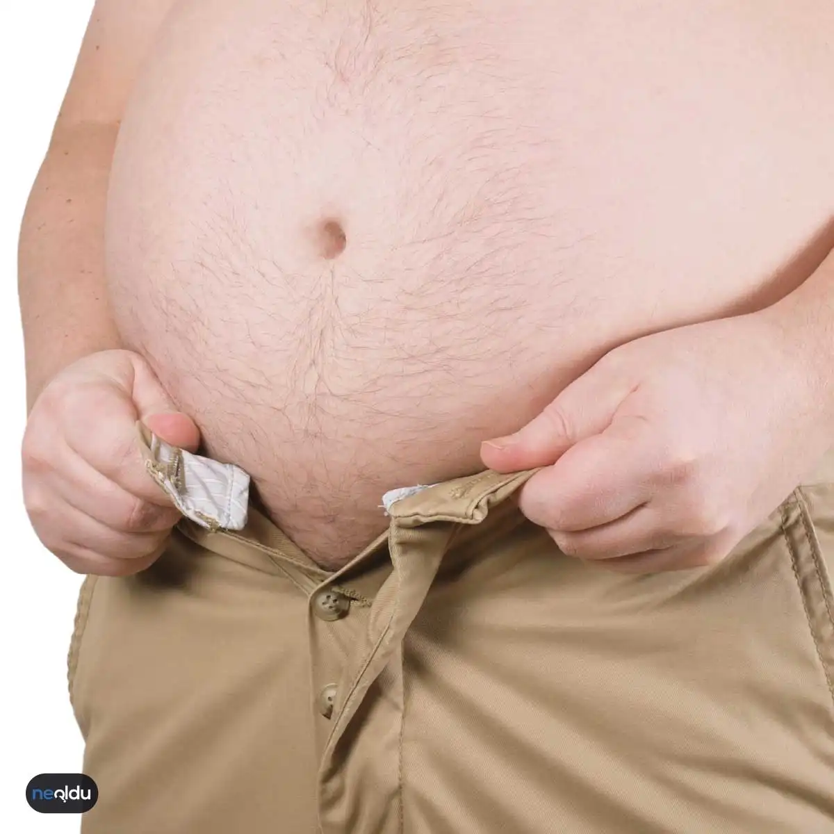 Obezite Tedavisi