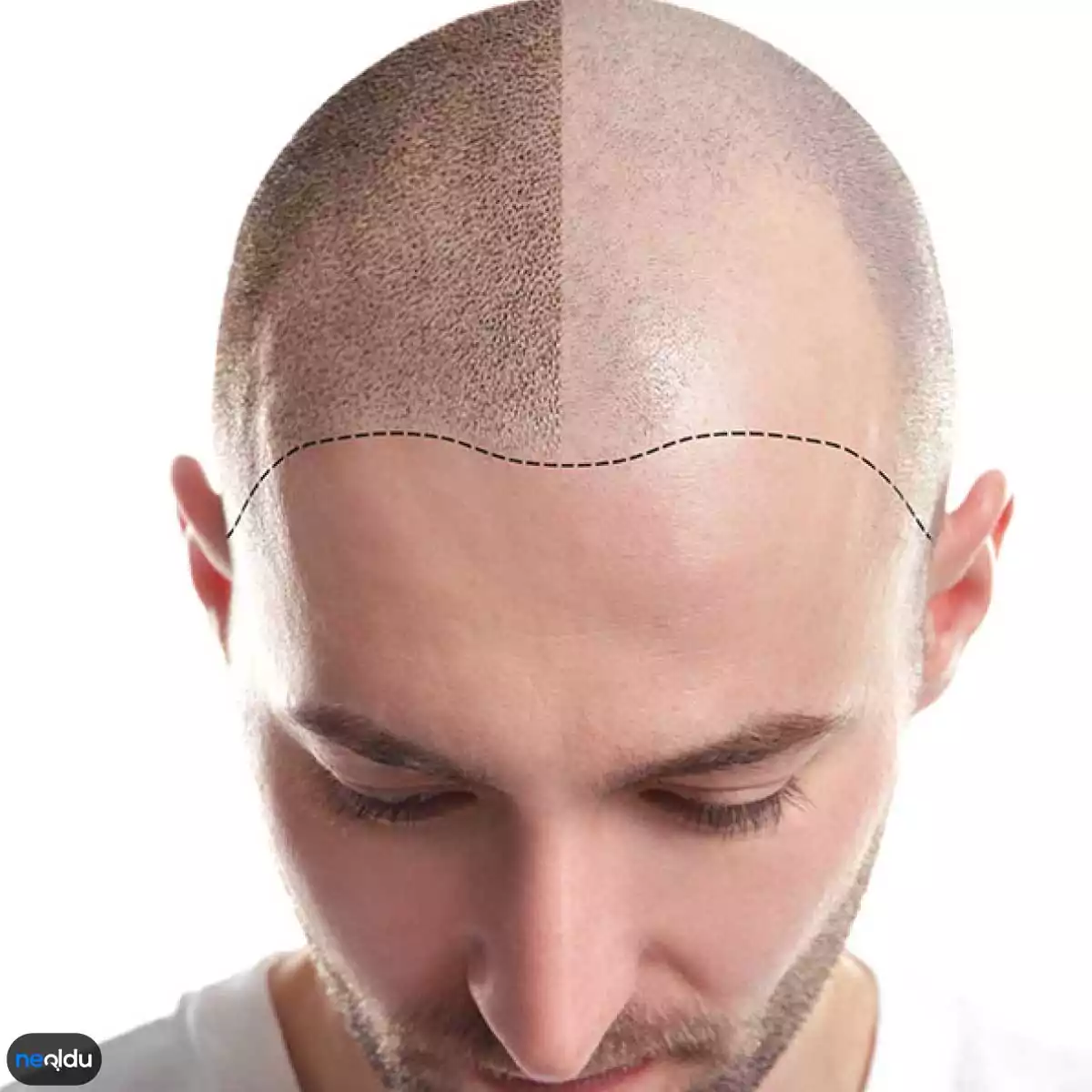 saç simülasyonu